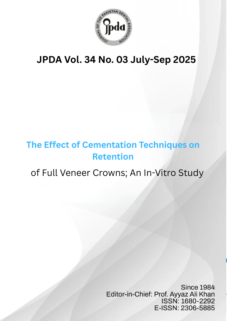 The Effect of Cementation Techniques on Retention of Full  Veneer Crowns; An In-Vitro Study